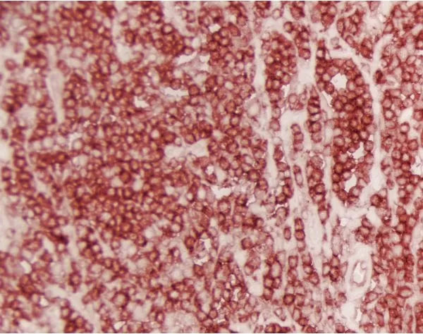 *ImmPACT AMEC Red, Peroxidase