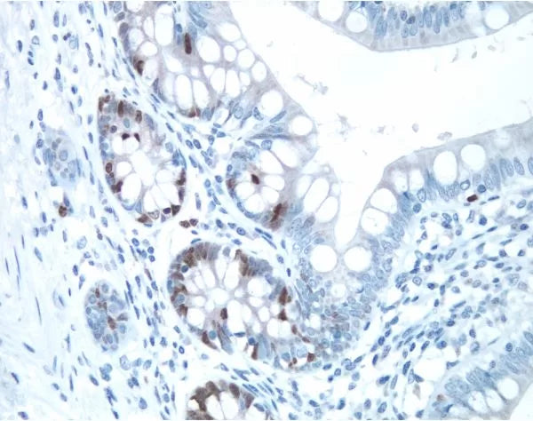 Image of VECTPK6101 - VECTASTAIN Elite ABC-Peroxidase Kit, Rabbit IgG