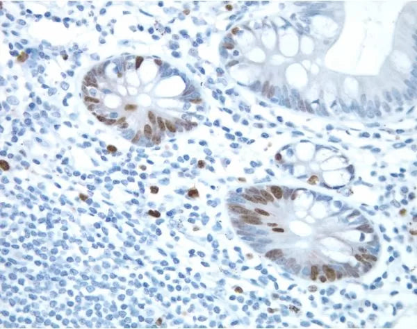 Image of VECTMP740115 - ImmPRESS Anti-Rabbit IgG Reagent, made in horse, Peroxidase
