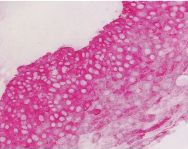 Image of VECTSK5100 - Vector Red Substrate Kit, Alkaline Phosphatase