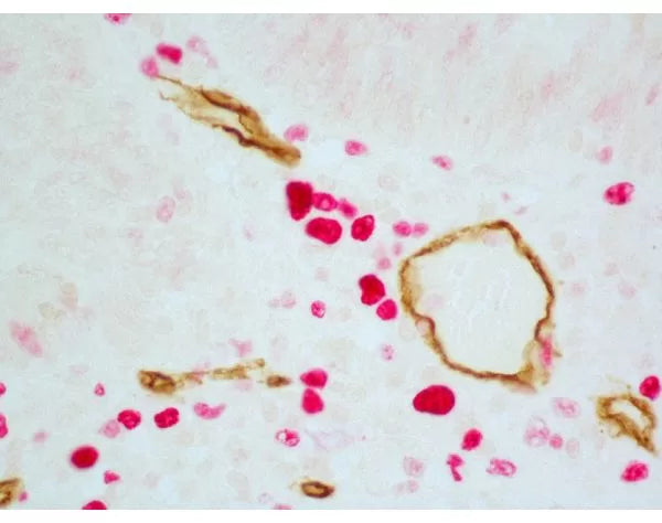 Image of VECTMP7714 - ImmPRESS Duet Double Staining HRP/AP Polymer Kit (anti-rabbit IgG-brown, anti-mouse IgG-red)