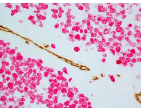 Image of VECTMP7724 - ImmPRESS Duet Double Staining HRP/AP Polymer Kit (anti-mouse IgG-brown, anti-rabbit IgG-red)