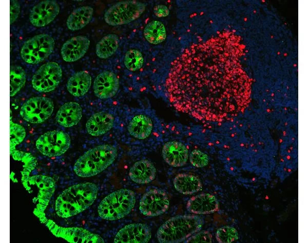 Image of VECTDK8828 - VectaFluor Duet Immunofluorescence Double Labeling Kit, DyLight 594 Anti-Rabbit (red)/DyLight 488 Anti-Mouse (green)