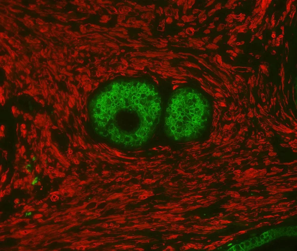 Image of VECTDK8818 - VectaFluor Duet Immunofluorescence Double Labeling Kit, DyLight 488 Anti-Rabbit (green)/DyLight 594 Anti-Mouse (red)