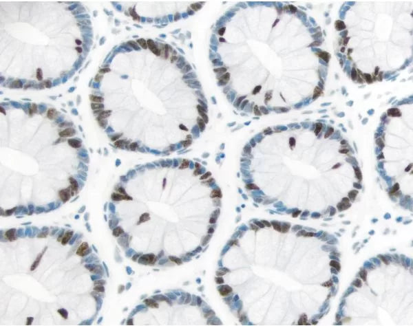 Image of VECTMP760115 - ImmPRESS Excel Staining Kit, Anti-Rabbit IgG, Peroxidase