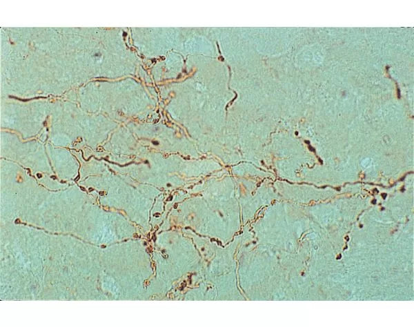 Phaseolus vulgaris Leucoagglutinin (PHA-L), Unconjugated