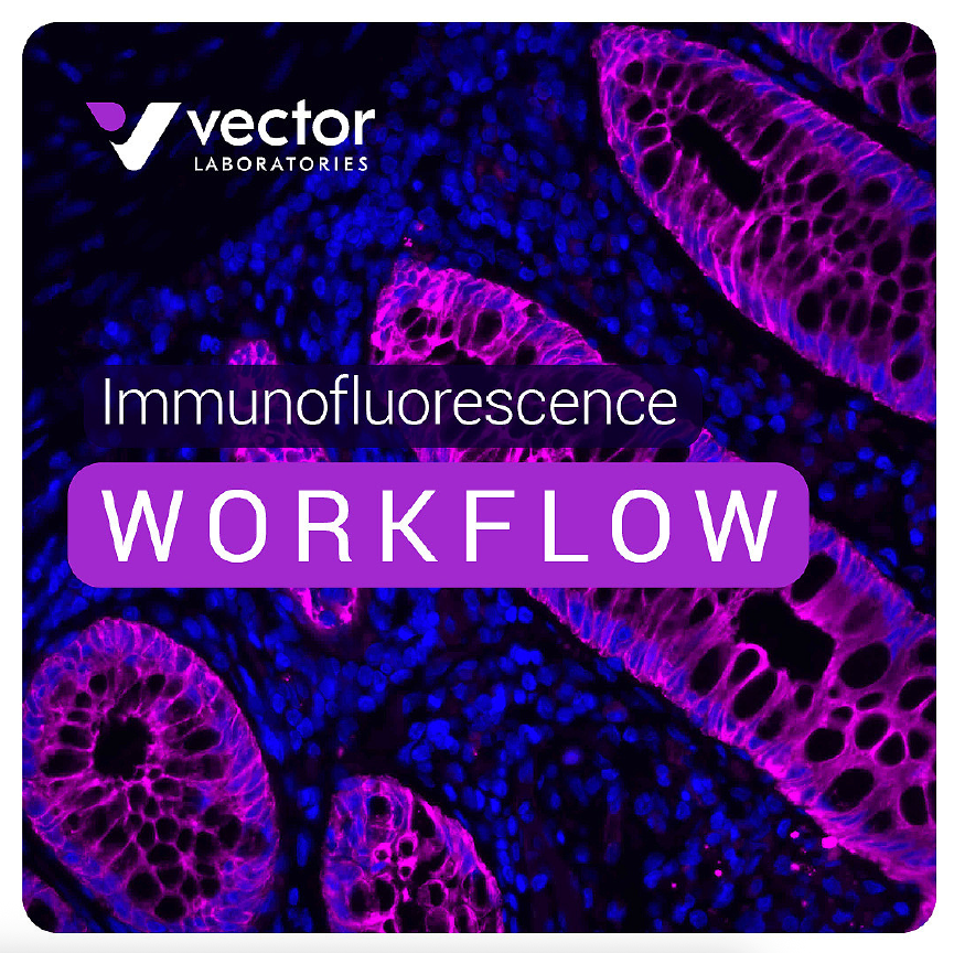 Immunofluorescence Workflow