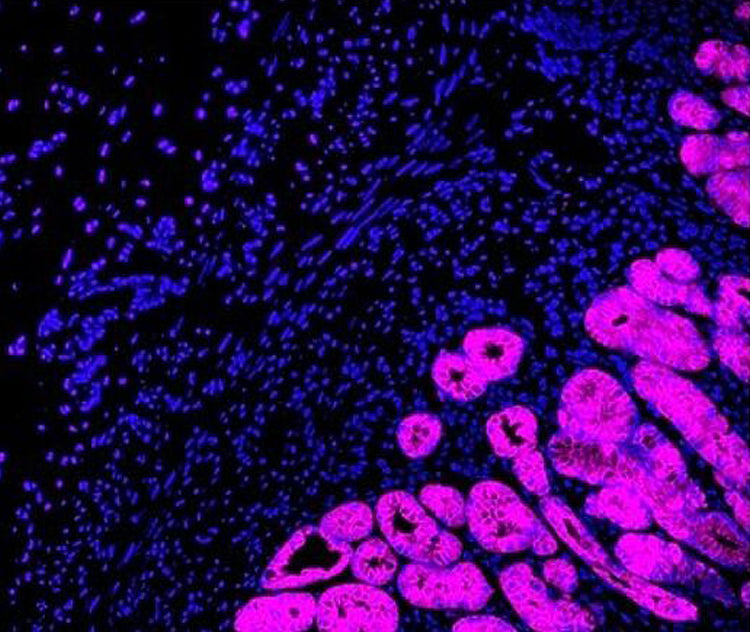 VectaPlex™ Antibody Removal Kit