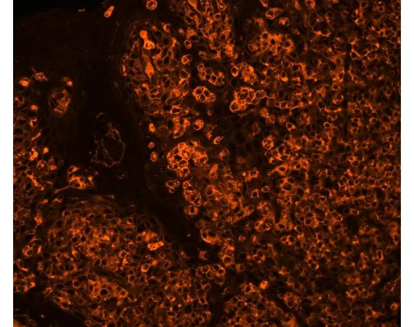 Image of VECTCL1303 - Cy3 labeled Sambucus Nigra Lectin (SNA, EBL)