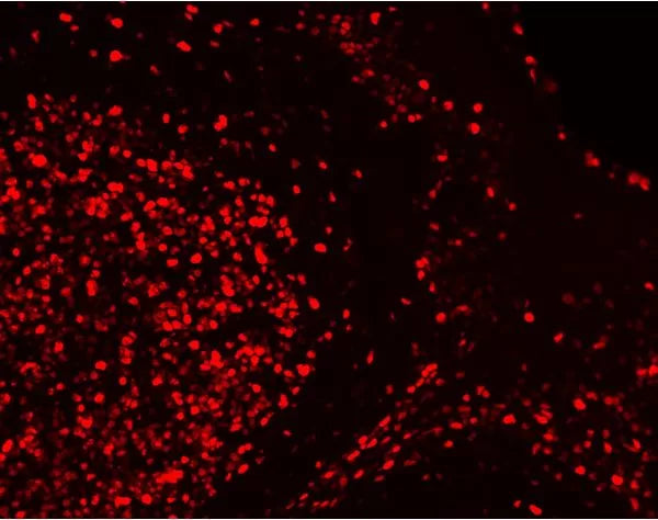 Image of VECTDK1594 - VectaFluor Excel R.T.U. Antibody Kit, DyLight 594, Anti-Rabbit