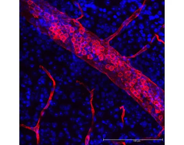 Image of VECTDL1177 - DyLight 594 Lycopersicon Esculentum (Tomato) Lectin, Affinity Purified