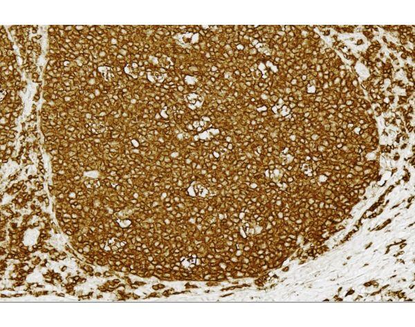 Image of VECTPK8200 - VECTASTAIN Elite ABC Universal PLUS Kit, HRP (Horse Anti-Mouse/Rabbit IgG)