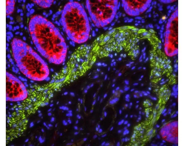 Image of VECTH20002 - VECTASHIELD PLUS Antifade Mounting Medium with DAPI, 2 mL