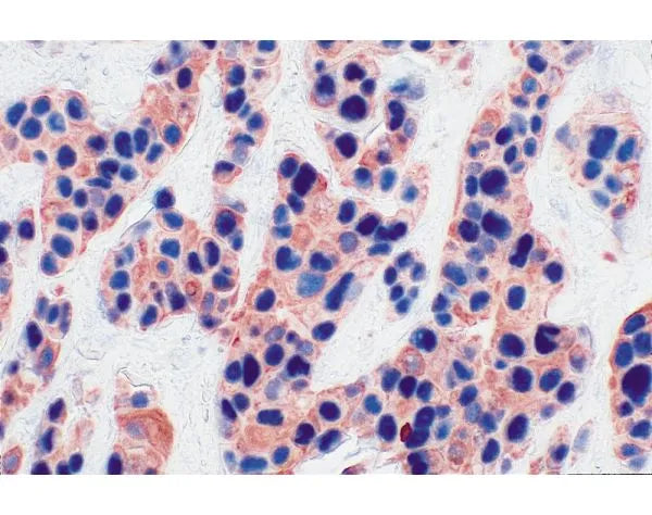 Image of VECTAK5002 - VECTASTAIN® ABC-AP Kit, Alkaline Phosphatase (Mouse IgG)