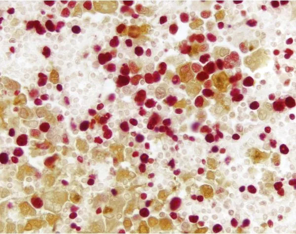Image of VECTAK5200 - VECTASTAIN® ABC-AP Kit, Alkaline Phosphatase (Universal)