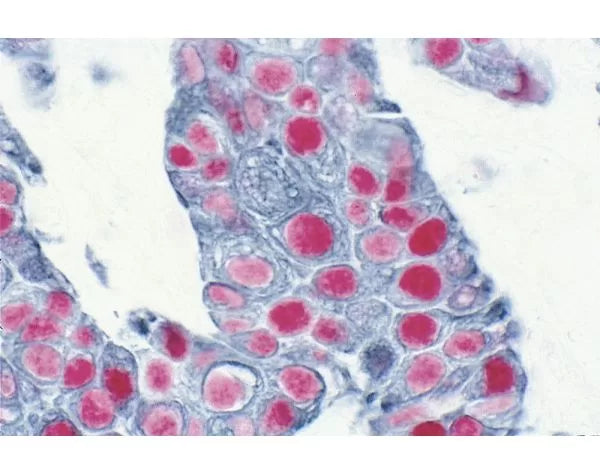 Image of VECTAK5000 - VECTASTAIN® ABC-AP Kit, Alkaline Phosphatase (Standard)