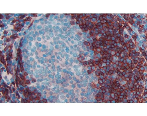 Image of VECTMP744415 - ImmPRESS Anti-Rat IgG (Mouse Adsorbed) Reagent, made in goat, Peroxidase