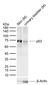 ***P63 Recombinant Rabbit Monoclonal Antibody, 25 µL