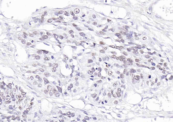 ***P63 Recombinant Rabbit Monoclonal Antibody, 25 µL