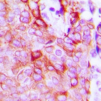 ***Rabbit LPHN2 Polyclonal Antibody, 30 µL