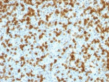 ***PDCD1 Antibody / PD-1 / PD1, 20 µg