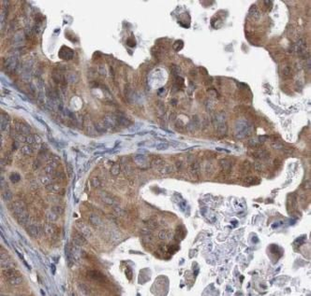 ***Cofilin Antibody, 50 µg