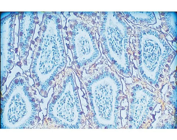 Image of VECTB1155 - Jacalin, Biotinylated