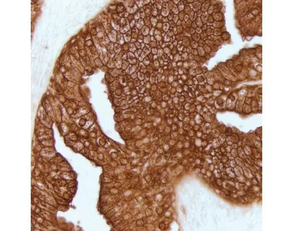 Image of VECTSK4103 - ImmPACT DAB EqV Peroxidase (HRP) Substrate