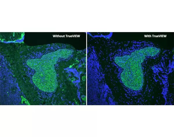 Image of VECTSP8500 - Vector TrueVIEW Autofluorescence Quenching Kit with DAPI