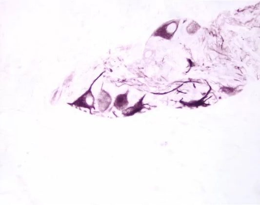 Vector® VIP Substrate Kit, Peroxidase (HRP)