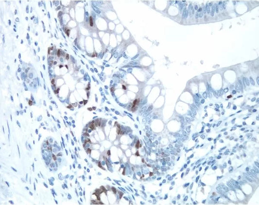 VECTASTAIN Elite ABC-Peroxidase Kit, Rabbit IgG