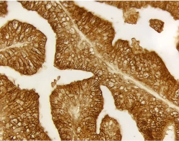 ImmPACT DAB Peroxidase (HRP) Substrate