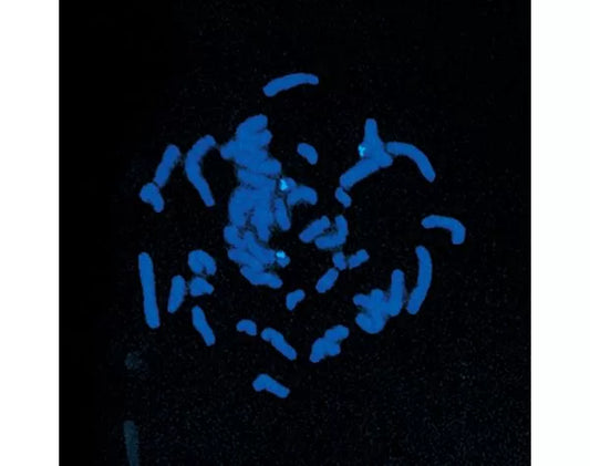 VECTASHIELD with DAPI