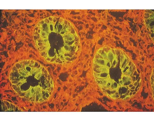 Lycopersicon esculentum lectin (LEL, TL), Biotinylated