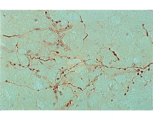 Phaseolus vulgaris Leucoagglutinin (PHA-L), Unconjugated