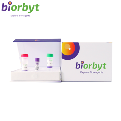***SREBP1 Polyclonal Antibody, 30 µL