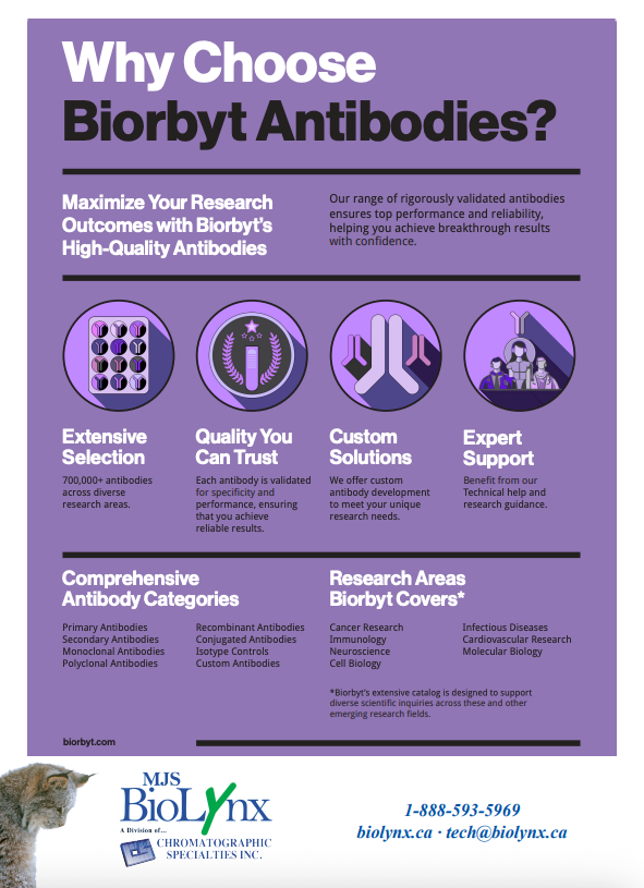 Why Choose Biorbyt Antibodies?