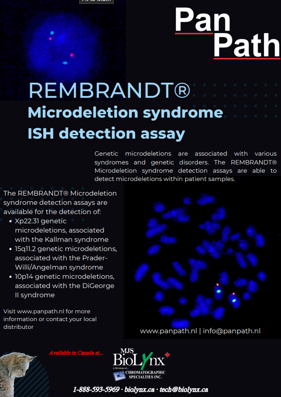 Rembrandt Microdeletion syndrome