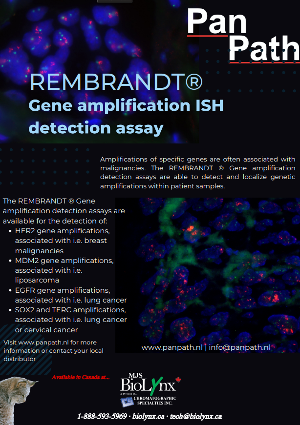 Rembrandt Gene amplification