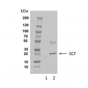 ***Exosome Starter Pack including EX01-8 Exosome Purification Kit and EX205 NTA Samples