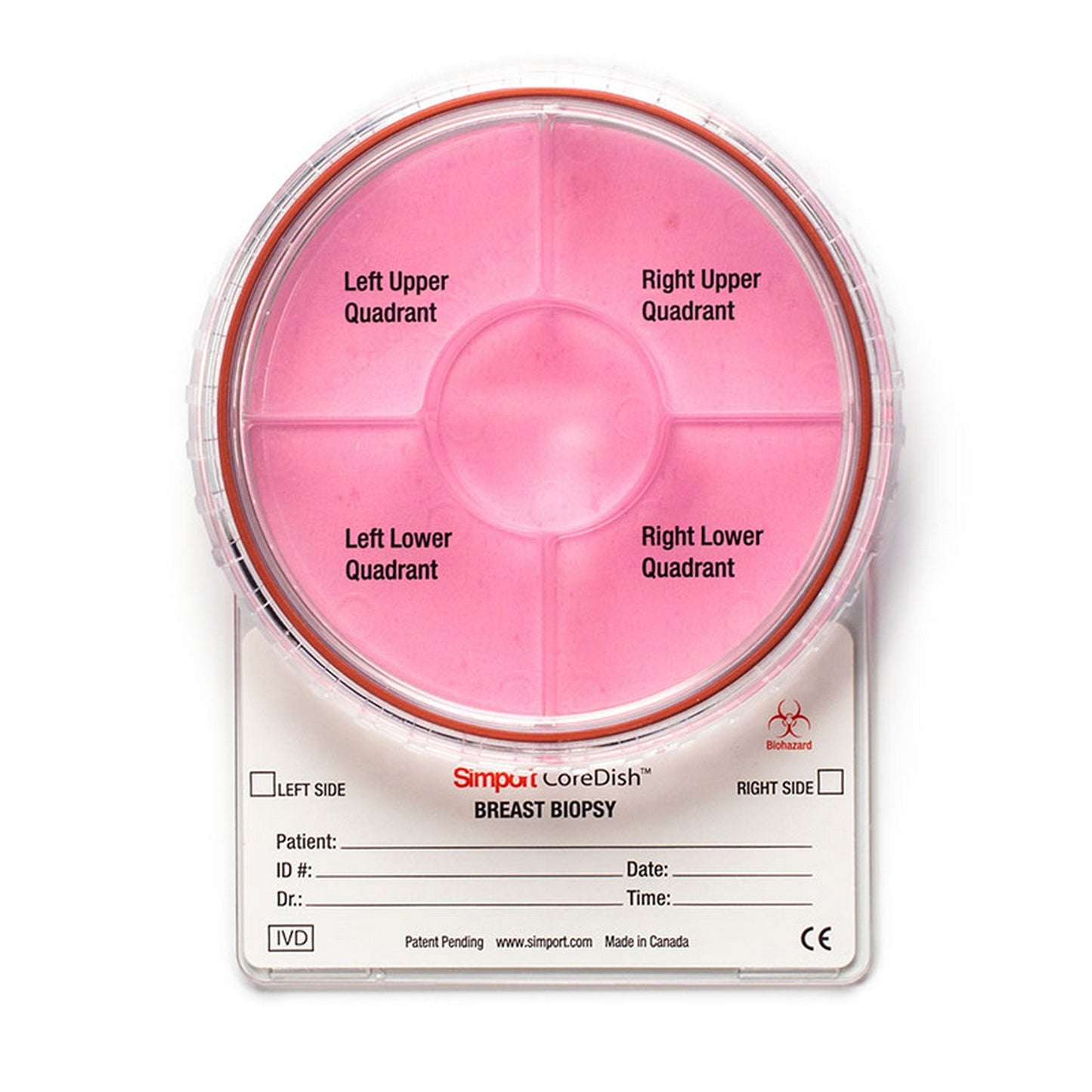 CoreDish® Breast Biopsy container : Prefilled with Formalin
