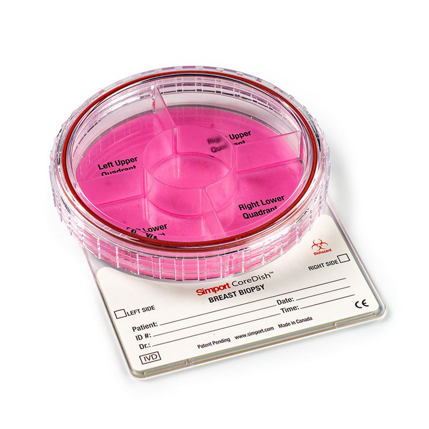 CoreDish® Breast Biopsy container : Prefilled with Formalin