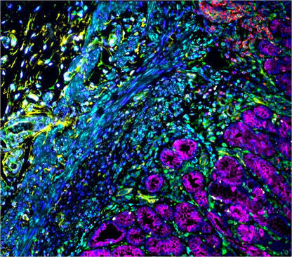 VectaPlex™ Antibody Removal Kit
