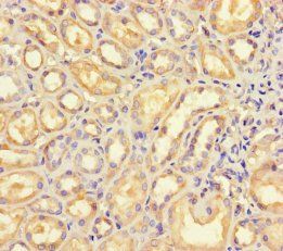 ***B4GALT5 Polyclonal Antibody, 100 µg