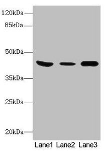 ***B4GALT5 Polyclonal Antibody, 100 µg