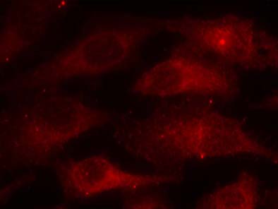 ***Caveolin (Phospho-Tyr14) Antibody, 50 µL