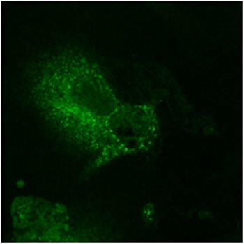 ***EEA1 Polyclonal Antibody, 100 µg