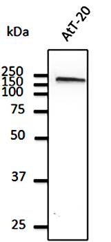 ***EEA1 Polyclonal Antibody, 100 µg