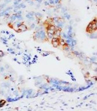 ***GST3/GST pi/GSTP1 Polyclonal Antibody, 100 µg