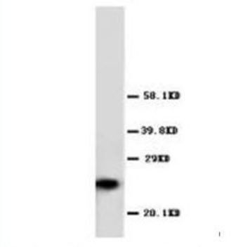 ***GST3/GST pi/GSTP1 Polyclonal Antibody, 100 µg